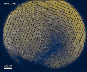 Evaporating sessile droplets: solutal Marangoni effects overwhelm thermal Marangoni flow